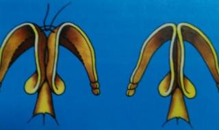 缩小鼻头手术多少钱 缩小鼻头手术多少钱